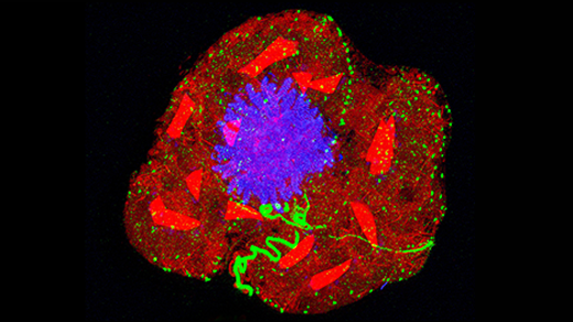 ¿Tus Fotos de Instagram Son Robadas o Meras Memes? 📸