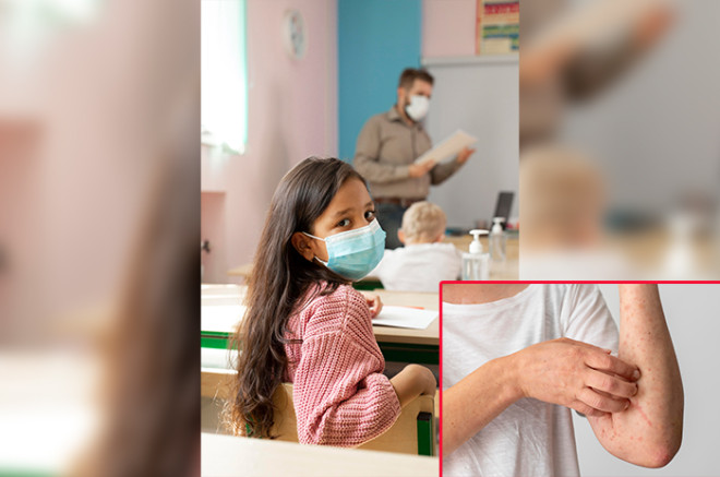 😷 ¿Jalisco se Descoloca o es el Sarampión el Verdadero Problema?